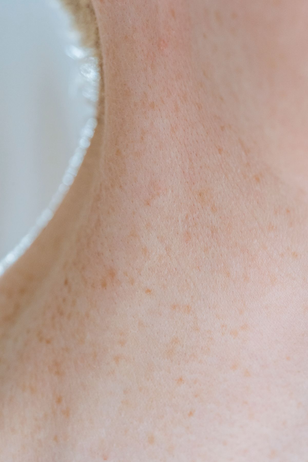 skinchick — men's health research